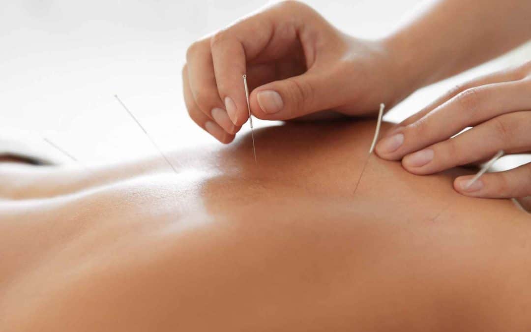 Acupuncture vs. Massage, Chiropractic Care, and Physical Therapy: What’s the Difference?