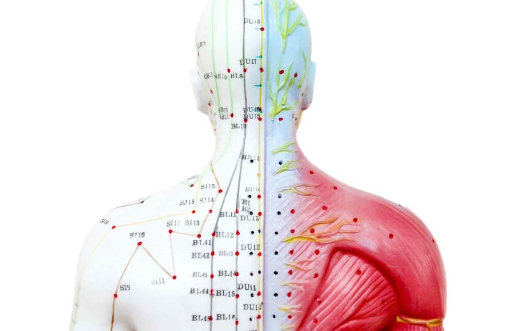 Is Acupuncture Covered by Insurance in New Jersey? What Patients Should Know